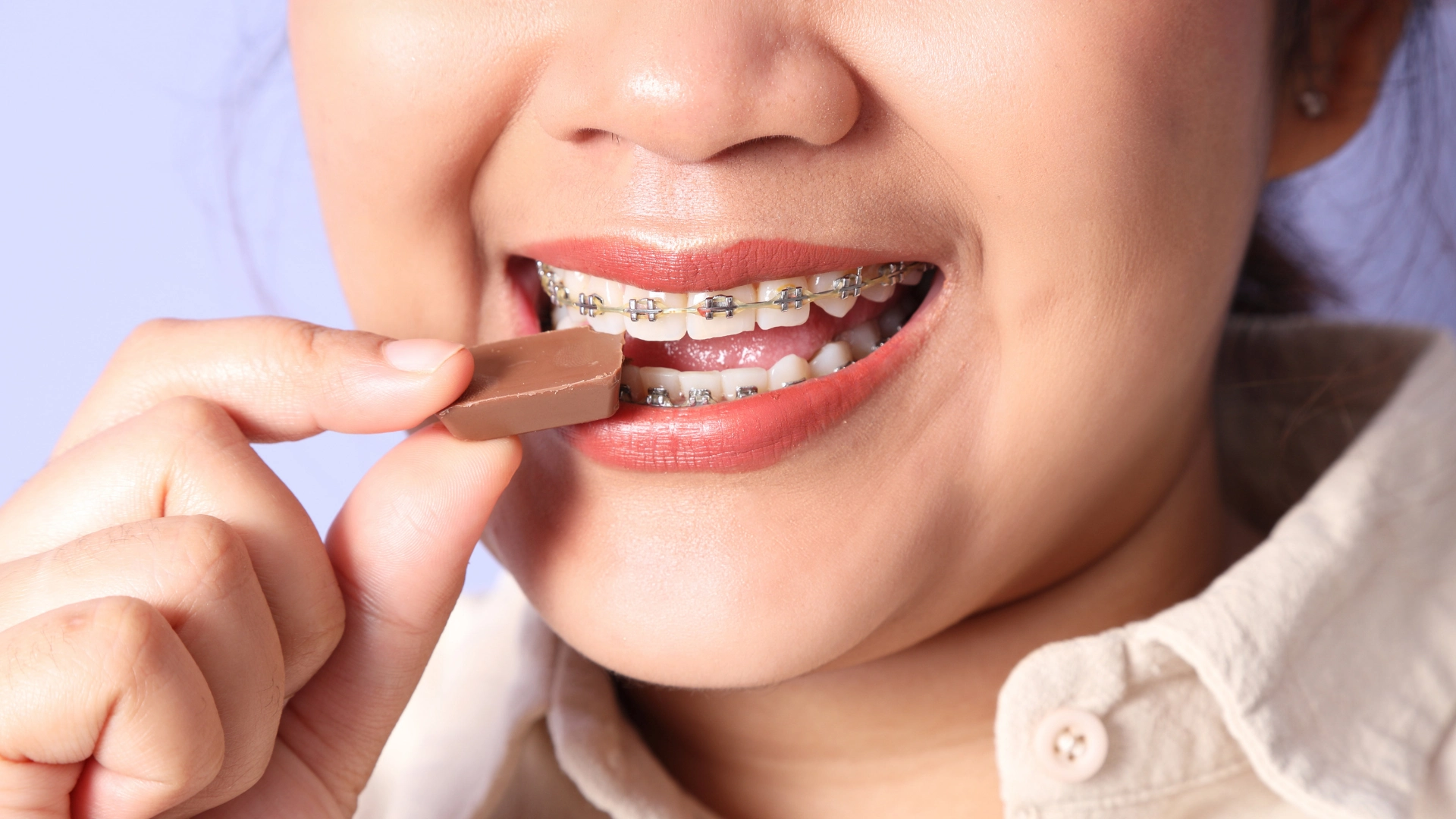 foods to avoid when you have braces