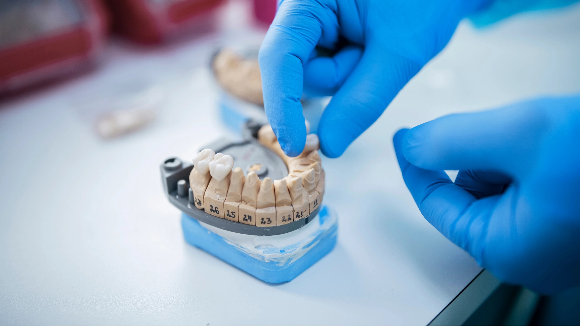 replace a single tooth