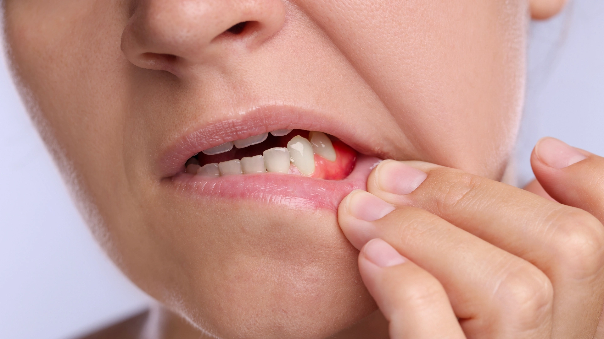 reverse gum disease