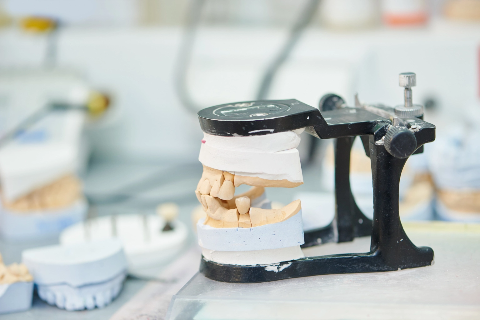 choosing dental implants or bridges
