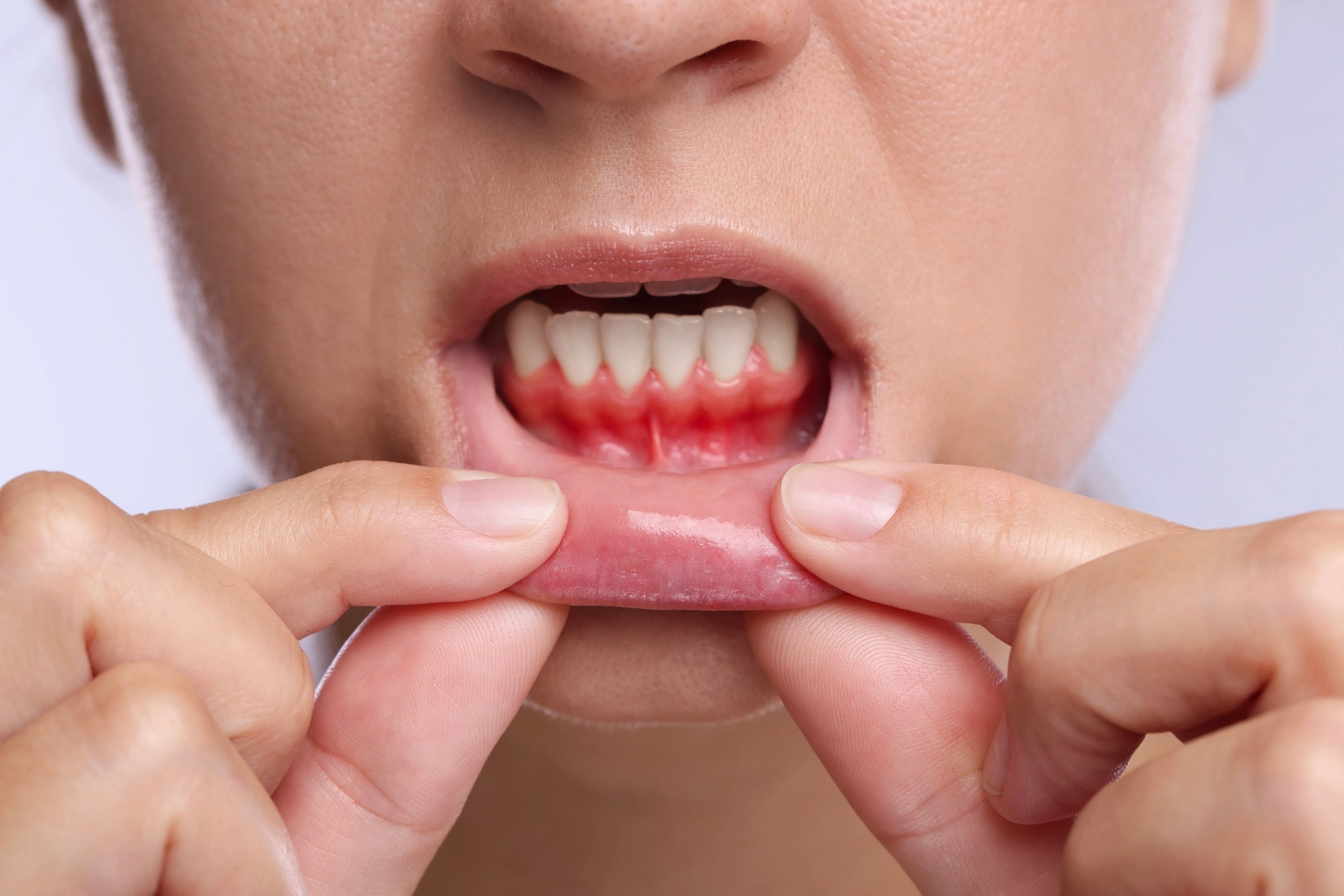 gum contouring for a balanced smile