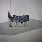 all on 4 teeth implantscottsdale az.jpg