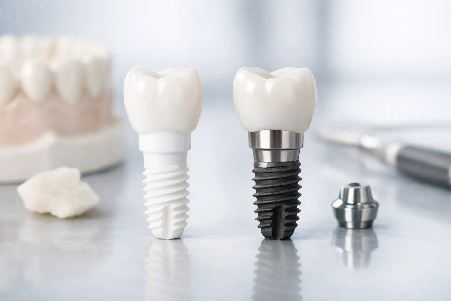 Zirconia Implants vs Titanium Implants: Which Fits?